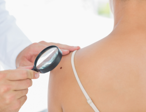 Combattere il melanoma con un sapone?