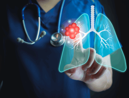 Tumore al polmone: la broncoscopia robotica migliora la diagnosi dei noduli più piccoli