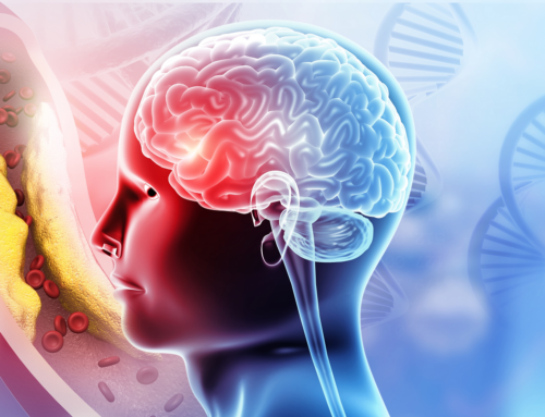 Ictus: riconoscerlo subito, curarlo meglio, prevenirlo è possibile