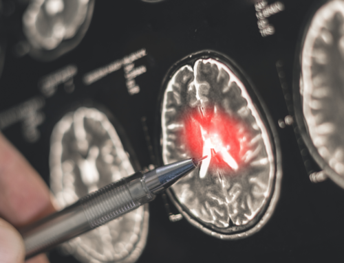 Sclerosi multipla in età pediatrica: confermato il legame con la “malattia del bacio”