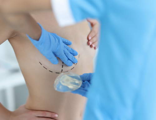Protesi mammarie in Italia: la ricostruzione supera gli interventi estetici
