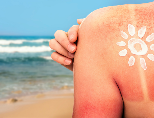 Sole e melanoma: cosa dice davvero la scienza sulla prevenzione