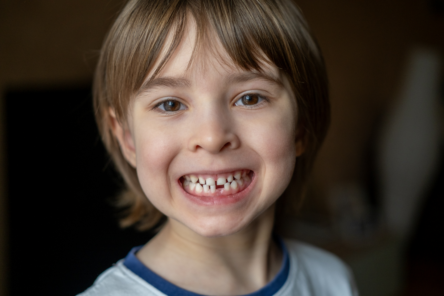 Denti da latte e microbiota orale perché il primo dentino è così importante